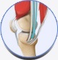 ACL reconstruction Hamstring Tendon