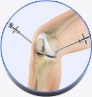 Arthroscopy Of The Knee Joint