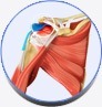 Rotator Cuff Tear